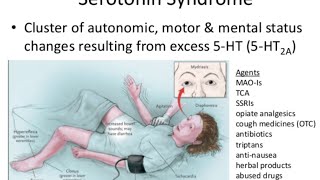 Serotonin Syndrome [upl. by Asenev]