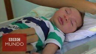 Virus zika quotMi bebé tiene microcefaliaquot [upl. by Cahra]