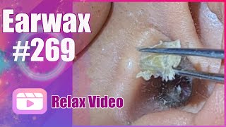 Remove earwax with tweezers  how to remove wax from ear [upl. by Jamal]