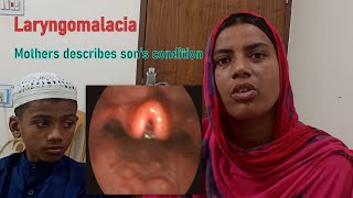 Laryngomalacia Laryngoscopy amp Clinical Feature। Natural History। Mother Describes Sons Condition [upl. by Sorodoeht636]