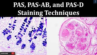 PAS PAS AB and PAS D Staining Techniques  Principal Procedure histopathology laboratory [upl. by Ijic]