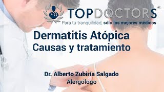 Dermatitis atópica Descubre sus causas y tratamiento [upl. by Notnil]