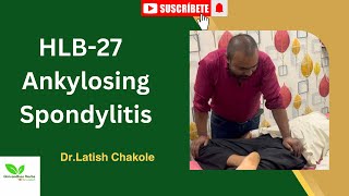 HLB27 Ankylosis Spondylitis  Treatment By Girivardhan Herbs Bone Setting [upl. by Ahselak]