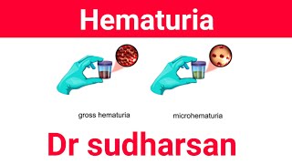 Approach To Hematuria  Types amp Management Dr Sudharsan [upl. by Martie]