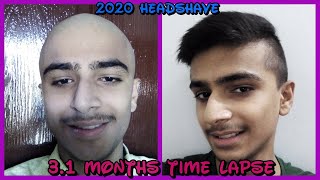 My 2020 Headshave 31 Months Hair Growth Time Lapse [upl. by Mckenzie952]