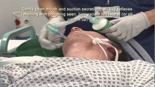 Intubation Extubation 67 [upl. by Llevert]