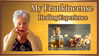 Frankincense Helped me A Cancer Survivors Journey [upl. by Yrahca959]