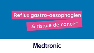 Reflux gastrooesophagien amp risque de cancer associé [upl. by Calia]