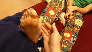 Curing Athletes Foot Fast  Iodine Antifungal Cream and Saran Wrap [upl. by Si]