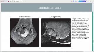 EXPERT DDX BRAIN AND SPINE IMAGING [upl. by Sunderland]