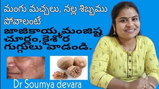 Mangu machalu povalanteNalla shibbamBonguMelasmaHyper pigmentation  Ayurvedam TeluguDr Soumya [upl. by Olra]