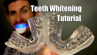 Home Teeth Whitening Tutorial  How To Whiten Your Teeth At Home For Best Results [upl. by Hsima]