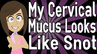 My Cervical Mucus Looks Like Snot [upl. by Tlok]