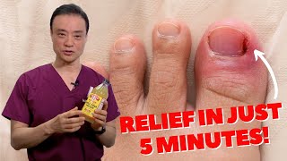 6 HOME REMEDIES To Treat A PAINFUL Ingrown Nail  Dr Kim [upl. by Kinghorn]