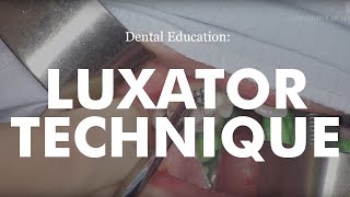 Demonstration of Luxator Technique for Dental Extraction [upl. by Aeneus275]