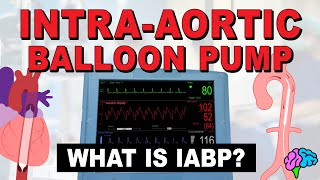 What is an IntraAortic Balloon Pump IABP [upl. by Oirretno331]