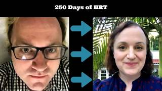 MTF  The First 250 Days of Transition  Male to Female Transgender Timeline [upl. by Faustus739]