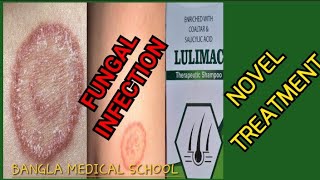 Chronic fungal infection Novel treatment of fungal infection দীর্ঘ মেয়াদি ফাংগাল ইনফেকশন। [upl. by Nived]