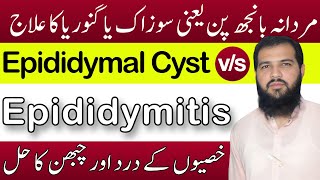 Epididymitis treatment in hindi  Epididymal cyst treatment  sozak Ka ilaj  Epididymitis [upl. by Port431]