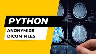 Dicom Anonymization Using Python [upl. by Kery]