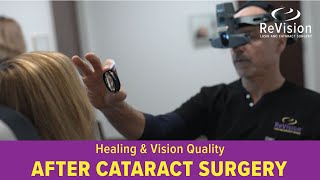 No Glasses After Cataract Surgery Lens Implant Options Explained [upl. by Eirret]