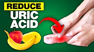 12 Foods That Reduce Your Uric Acid Levels [upl. by Shiff]