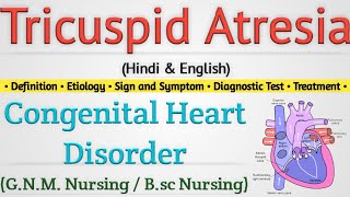 Tricuspid Atresia  Tricuspid Atresia In Hindi  Congenital Heart Disease [upl. by Atterahs]