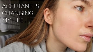 2 MONTH ACCUTANE JOURNEY UPDATE FOR MILD ACNE  SIDE EFFECTS amp SKINCARE ROUTINE [upl. by Jessie]