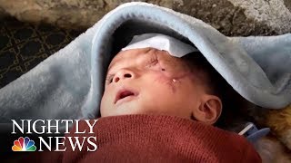 Syria’s Wounded Are Not The Only War Casualties  NBC Nightly News [upl. by Anwaf]