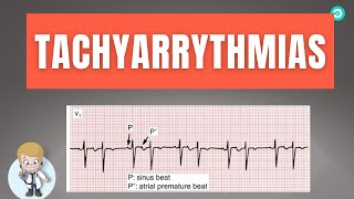 How to dignose Abnormal heart rhythm Tachyarrythmias On ECG  Step by step [upl. by Rickard2]