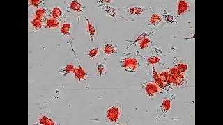 Interaction of SerumExposed Microglial Cultures with pHrodoLabeled Myelin Debris [upl. by Intirb]