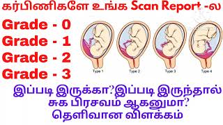 Placenta Grade 0placenta Grade 1 Grade 2Grade 3 என்றால் என்னPlacenta maturity grading in tamil [upl. by Elorak455]