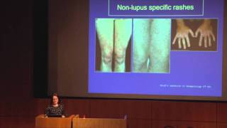 Lupus The Skin amp Hair  Dr Abby Macbeth East Anglia Lupus Info Day Oct 2013 [upl. by Harmonia]