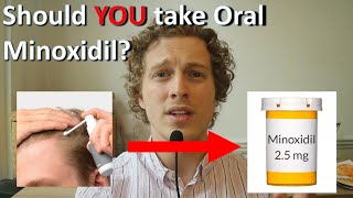 Oral Minoxidil For Hair Loss [upl. by Kuehnel629]