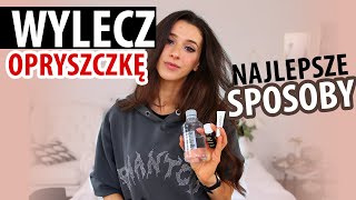 JAK POZBYĆ SIĘ OPRYSZCZKI najlepsze sposoby❤️ DZIAŁA [upl. by Ayahsal]