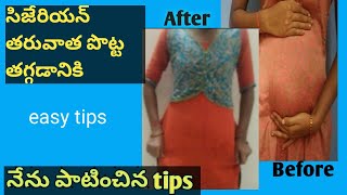 After cesarean belly reducing  how to burn belly fat in telugu  Fat reduce tips [upl. by Mirth330]