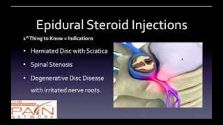 5 Things to Know About Epidural Steroid Injections 602 5076550 [upl. by Menis]