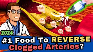 1 Food to Clean out Your Arteries Blood Clots amp Arteriosclerosis [upl. by Tracey]