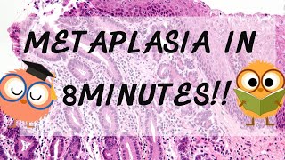 Metaplasia Pathology in 8 Minutes [upl. by Nine]