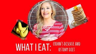 WHAT I EAT Crohns Disease and Ostomy Diet Tips [upl. by Onailil]