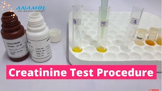 Serum Creatinine Test  Creatinine Blood Test [upl. by Rausch949]