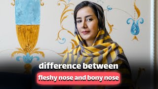 difference between fleshy nose and bony nose [upl. by Ottilie]