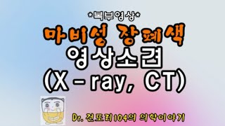 마비성 장폐색증paralyticadynamic ileus 영상소견abdominal Xray CT [upl. by Saied4]