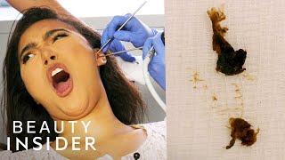 How Earwax Is Professionally Extracted  Beauty Explorers  Insider Beauty [upl. by Otter]