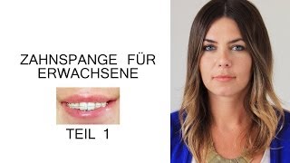 Zahnspange für Erwachsene  Der erste Schritt [upl. by Reaht70]