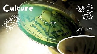 Urine Culture Test  Step by step guide 🌸🔬 Medical Laboratory  Microbiology  Procedure amp Results [upl. by Akimot]