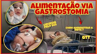 ALIMENTAÇÃO VIA GASTROSTOMIA  Como administrar a dieta pela gtt  CIRURGIA DE GTT PELO SUS [upl. by Nicolina]