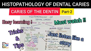 HISTOPATHOLOGY OF DENTAL CARIES  CARIES OF THE DENTIN PART2 [upl. by Soisanahta]