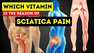 LIVE  This Vitamin DEFICIENCY Is Causing Your SCIATICA PAIN How These Vitamins Can Relieve Pain [upl. by Euqinad767]