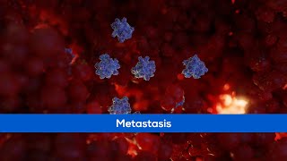 Medical Animation  Cancer Metastasis [upl. by Pate699]